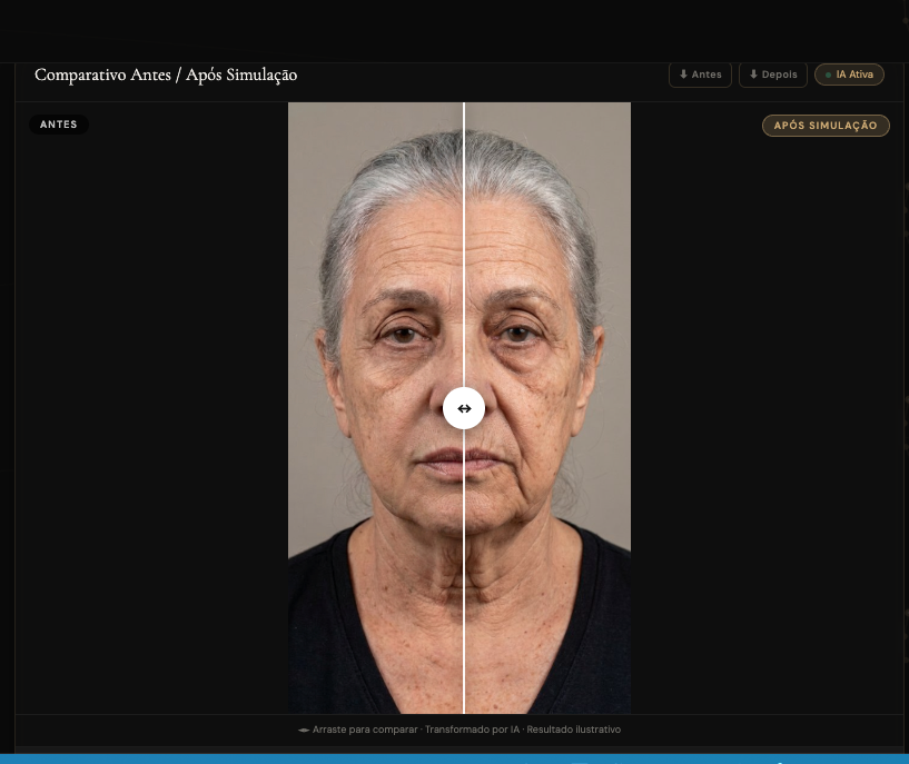 Rejuvenescimento 72
