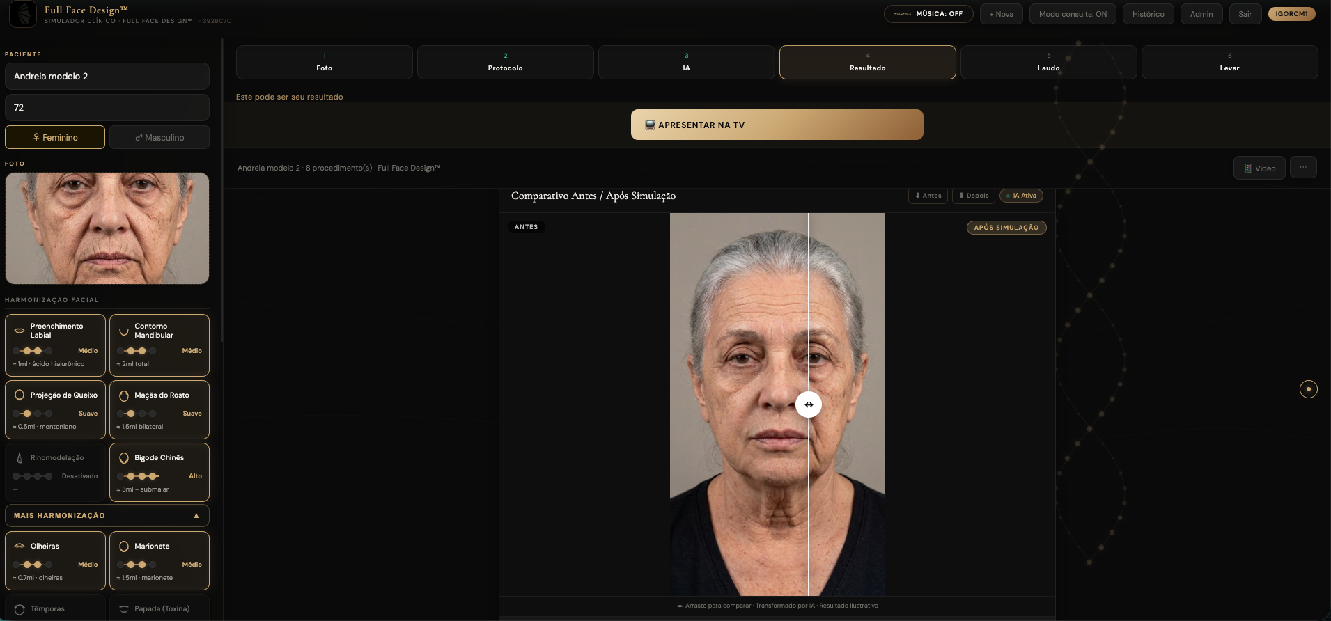 Face Plan clinical simulator — protocol, comparison and clinical summary