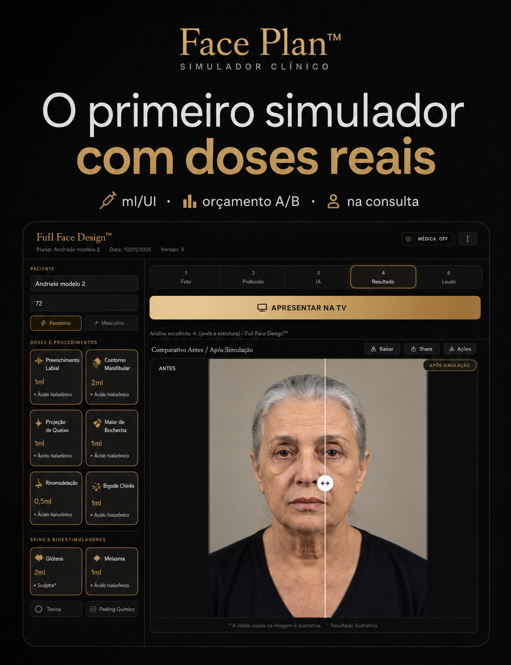 Face Plan™: simulador clínico com doses ml/UI, protocolo e comparativo antes/depois na consulta